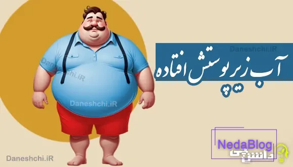 آب زیر پوستش افتاده