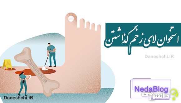 استخوان لای زخم گذاشتن