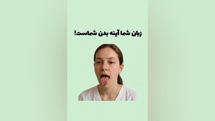 تشخیص بیماری از روی رنگ زبان