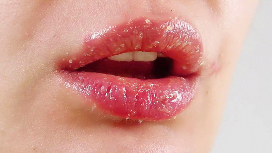 نرم کننده و حجم دهنده فوری لبها نسخه خانگی