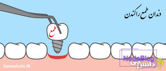 ضرب المثل دندان طمع را کندن